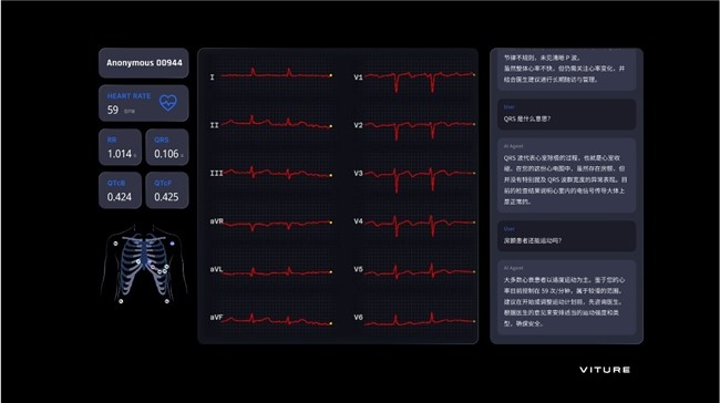 VITURE携手智源研究院发布全新XR AI 数字医疗应用
